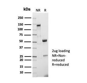 CD5 Antibody