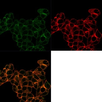 Lactoferrin Antibody / LTF