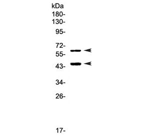 Western blot testing of human Raji cell lysate with TIM-3 antibody at 0.5ug/ml. Expected molecular w