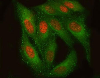 Immunofluorescent staining of FFPE human HeLa cells with TM2D3 antibody (green) and DAPI nuclear sta