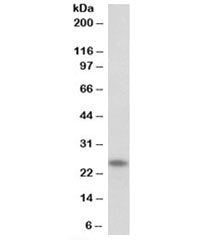TNNI1 Antibody