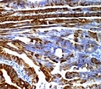 MUC2 Antibody / Mucin 2