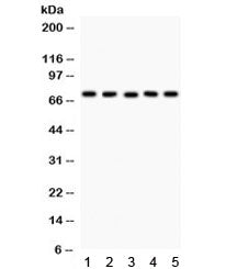 Western blot testing of 1) rat heart, 2) rat kidney, 3) rat liver, 4) rat lung, and 5) human SKOV ly