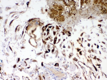 IHC testing of FFPE human placenta tissue with IGFBP1 antibody. Required HIER: steam section in pH8 
