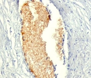 IHC: Formalin-fixed, paraffin-embedded human placenta stained with AMPD3 antibody (AMPD3/901)