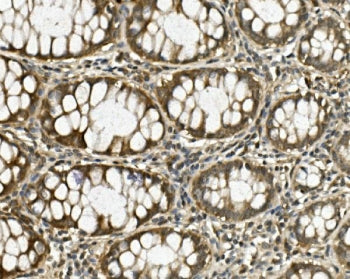 HRS Antibody / HGS / HGF-regulated tyrosine kinase substrate