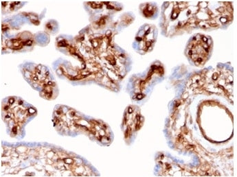 IHC staining of FFPE human placental tissue with Alpha II Spectrin antibody (clone SPTAN1/3507). HIE