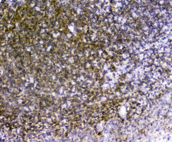 TRAIL Antibody