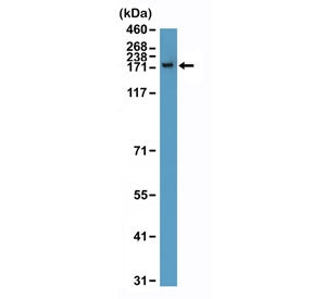Recombinant CPS1 Antibody / Carbamoyl phosphate synthetase 1
