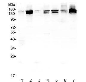 SHIP2 Antibody / INPPL1