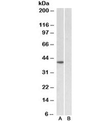 Western blot testing of HeLa nuclear [A] and cytosolic [B] lysates with TBP antibody at 1ug/ml. Pred