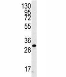 CDC2 Antibody