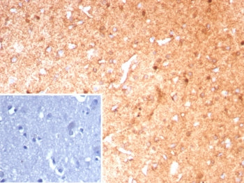 Glutamine Synthetase Antibody / GLUL