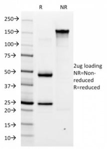 SDS-PAGE analysis of purified, BSA-free Helicobacter pylori antibody (clone HP/1334) as confirmation