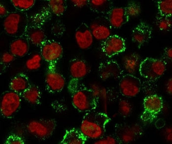 CD20 Antibody