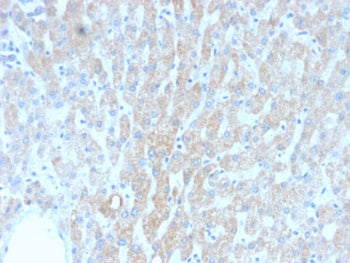 HSP60 Antibody