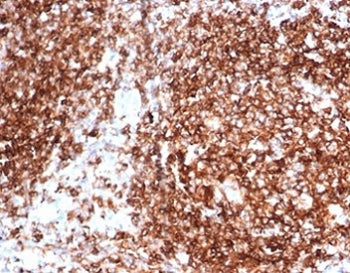 IHC staining of FFPE human tonsil tissue with Pan-HLA antibody (clone HLA-Pan/6663). HIER: boil tiss