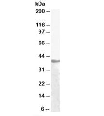 Alcohol dehydrogenase Antibody