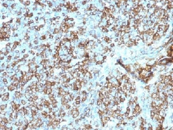 IHC testing of FFPE human tonsil tissue with HLA-DP/DQ/DR antibody (clone CR3/43). Required HIER: bo