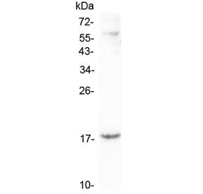 LEC Antibody / HCC-4 / CCL16