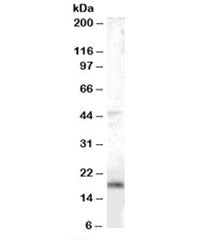 BAALC Antibody