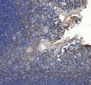 Collagen VII antibody / COL7A1