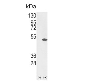 PEA3 Antibody / ETV4