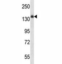 Insulin Receptor Antibody