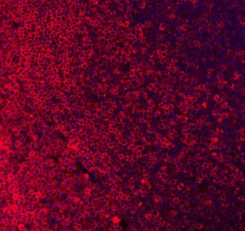Immunofluorescent staining of FFPE human tonsil tissue with CD79a antibody (red) and DAPI nuclear st