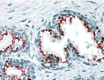 GOLPH2 Antibody