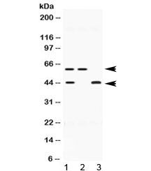Western blot testing of human 1) HeLa, 2) U-2 OS and 3) MCF7 lysate with E2F4 antibody at 0.5ug/ml. 