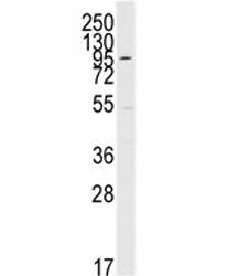 ERK5 Antibody (MAPK7)