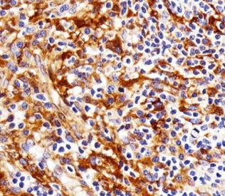 Immunohistochemical analysis of paraffin-embedded human tonsil using FYN antibody at 1:25 dilution.