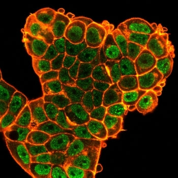 Immunofluorescent staining of PFA-fixed human MCF-7 cells using Bcl6 antibody (green, clone PCRP-BCL