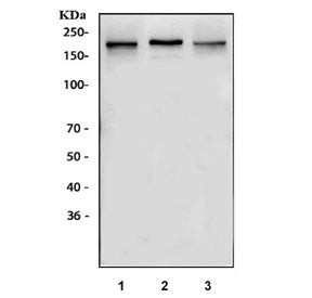 Western blot testing of 1) rat brain, 2) rat C6 and 3) mouse brain lysate with NMDAR2B antibody. Exp