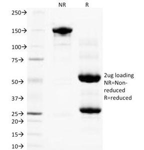 SDS-PAGE Analysis of Purified, BSA-Free PLGF Antibody (clone PLGF94). Confirmation of Integrity and 
