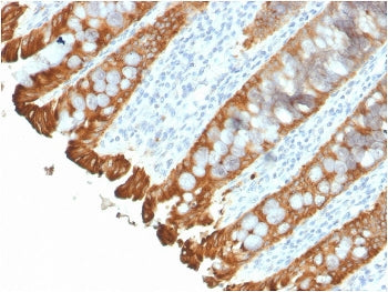 IHC staining of FFPE human colon with recombinant Cytokeratin 8/18 antibody (clone KRT8.18/2297R). H