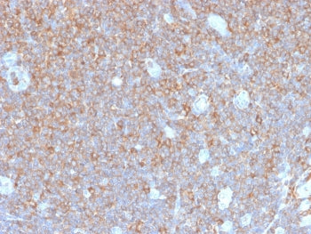 IHC staining of FFPE human tonsil tissue with recombinant PARVG antibody (clone PARVG/6312R). HIER: 