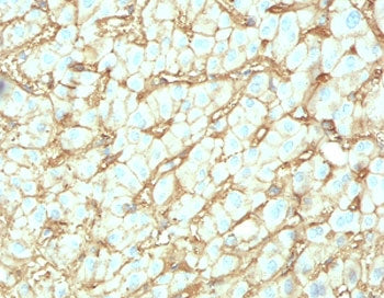 Albumin Antibody / ALB