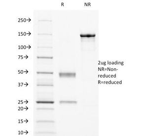 SDS-PAGE Analysis of Purified, BSA-Free CD32 Antibody (clone 8.7). Confirmation of Integrity and Pur
