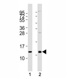 Western blot testing of CXCL12 antibody at 1:2000 dilution. Lane 1: human heart lysate; 2: mouse kid