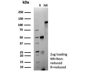 SDS-PAGE analysis of purified, BSA-free recombinant CD63 antibody (clone LAMP3/9191R) as confirmatio