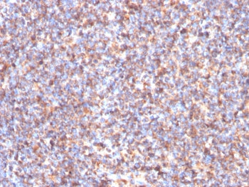 IHC staining of FFPE human tonsil tissue with Succinate dehydrogenase B antibody (clone SDHB/3204). 