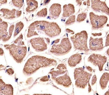 Myosin 18B Antibody / MYO18B