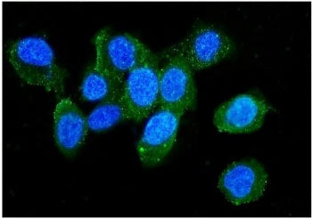 L Plastin Antibody / LCP1