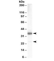 Western blot testing of human lung lysate with MCL1 antibody at 1ug/ml. Predicted molecular weight: 