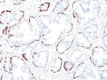 IHC staining of FFPE human prostate tissue with HMW Cytokeratin antibody (clone 34BE12). HIER: boil 