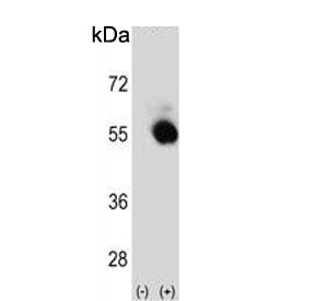 SBP Antibody / Selenium Binding Protein / SELENBP1