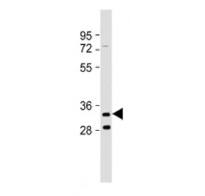 TMEM106B Antibody (C-Terminal Region)