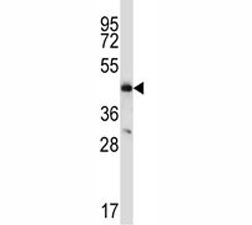 CCR9 Antibody